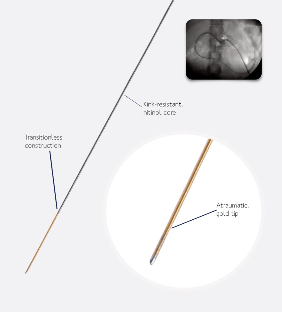 TORX Guidewires